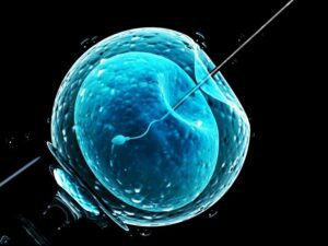 Assisted Reproductive Technology